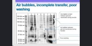 Read more about the article The Faculty of Veterinary Medicine at the University of Kerbala Organizing an Electronic Workshop entitled (Western Blot)