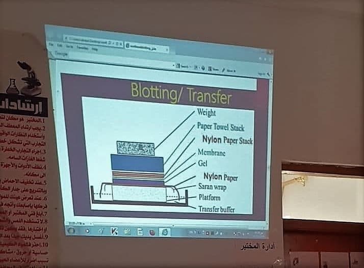 You are currently viewing University of Kerbala Organizing a Training Course entitled “Blotting Types and Uses”